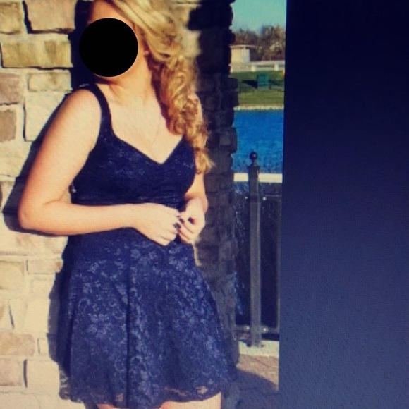 Blue lace semi formal dress short - Picture 3 of 4